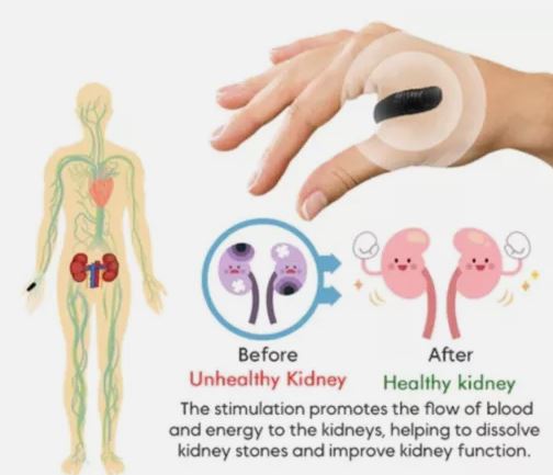 Sugar Control LI4 Acupressure Point Clip